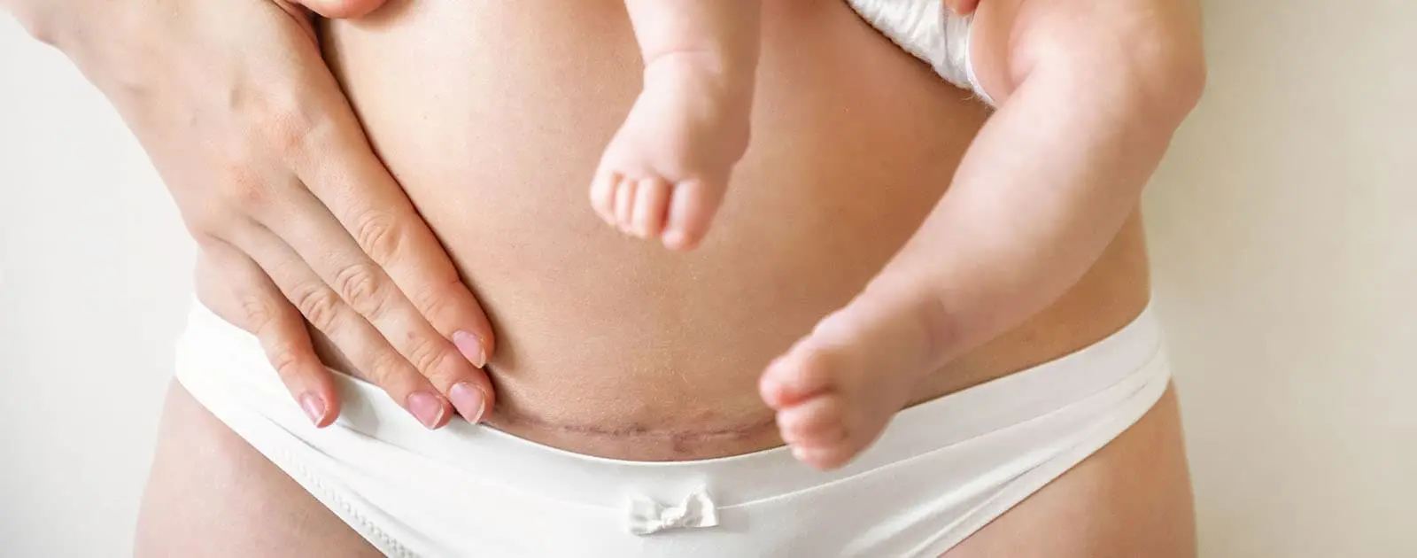 diastase-abdominal