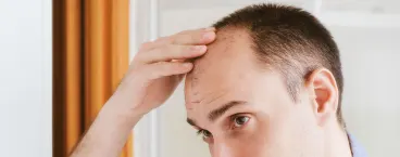 homem calvo a tocar na testa