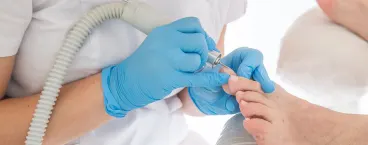 médico trata fungos nas unhas de paciente