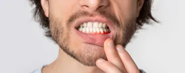 homem com gengiva inflamada