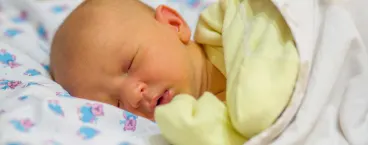 bebe com ictericia