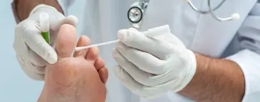 pé a receber tratamento 