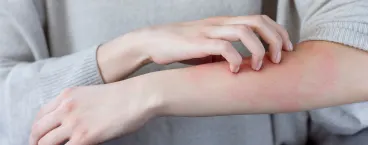 mulher a coçar o braço