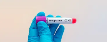 parasita toxoplasma