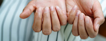 mulher com unhas quebradiças
