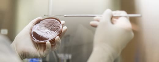 análise laboratorial de bactéria