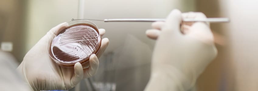 análise laboratorial de bactéria