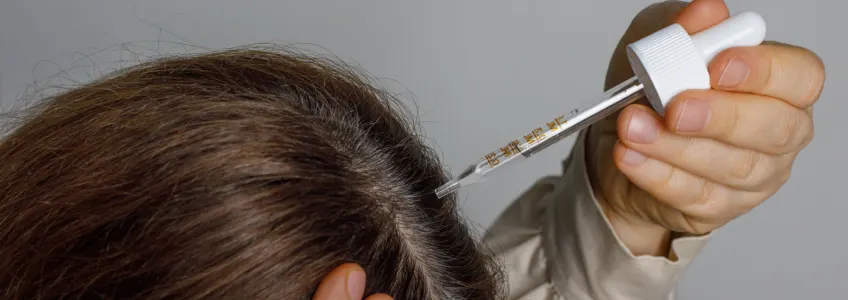 mulher a aplicar minoxidil no couro cabeludo