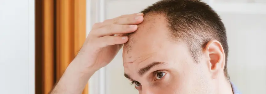 homem calvo a tocar na testa