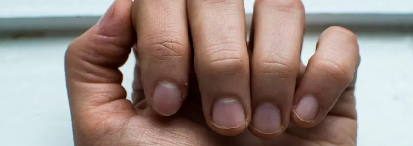 pormenor de unhas roídas