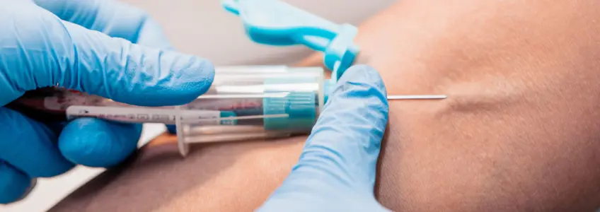 enfermeira a espetar alguns e braço de dador