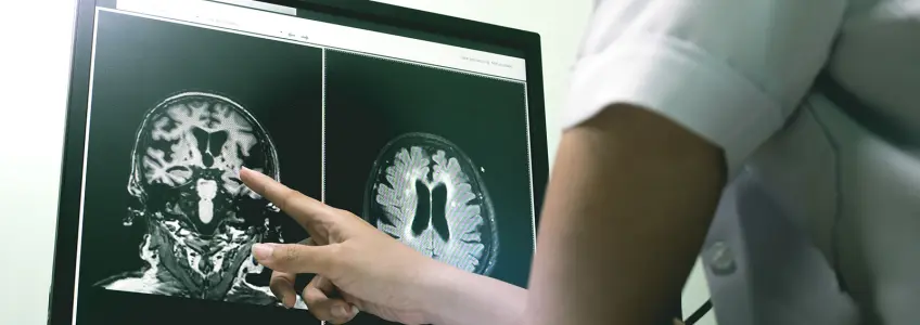 médica analisa ressonância magnética ao cérebro