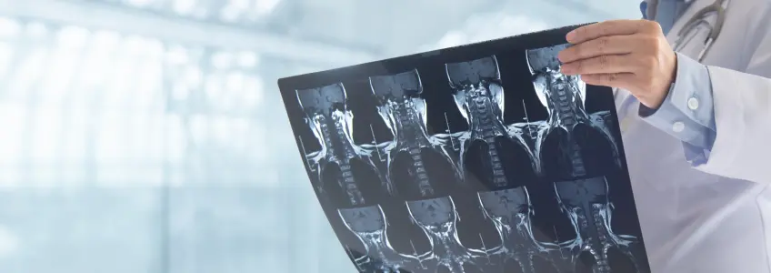 médico segura em radiografia da coluna