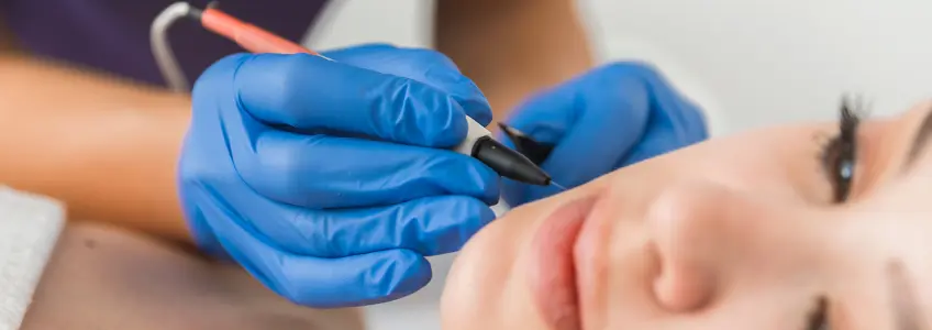 mulher a fazer tratamento facial para o excesso de pelos