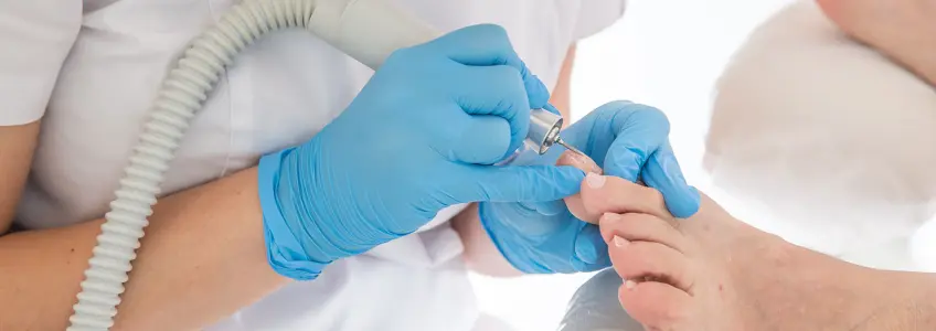 médico trata fungos nas unhas de paciente