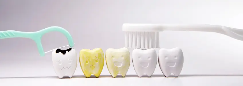 vários moldes de dentes