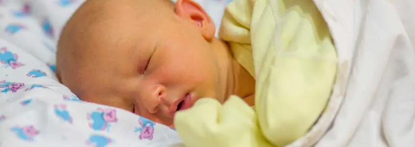 bebe com ictericia
