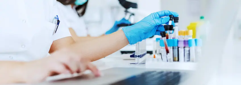 técnica de laboratório a analisar análises ao sangue