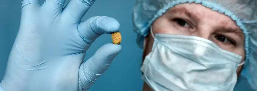 médico a mostrar uma pedra que se formou nos rins