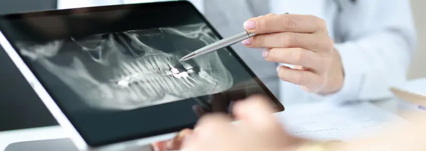 dentista mostra radiografia dentária a paciente