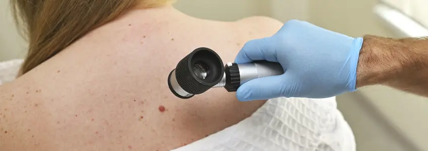 dermatologista avalia sinal de paciente