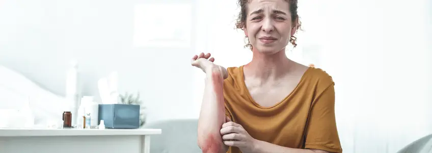 mulher com reação cutânea