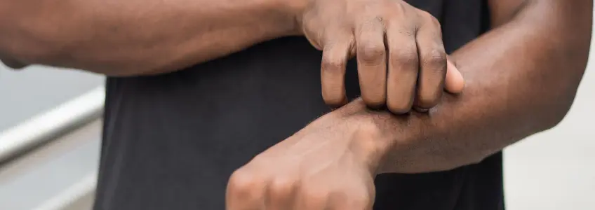 homem a coçar no braço