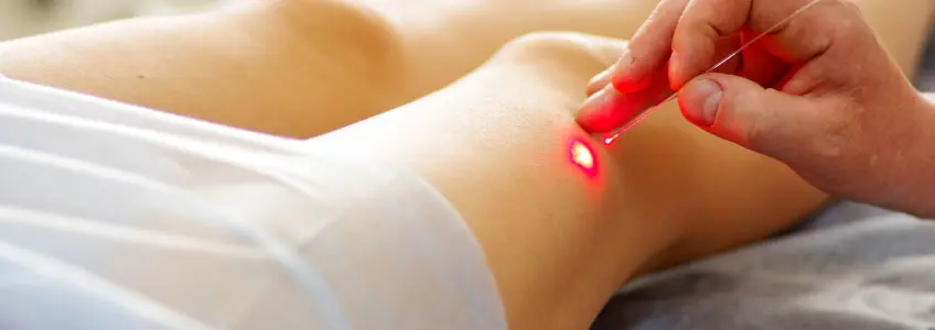 doutor a fazer tratamento a laser nas veias
